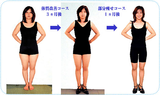 遺伝体質ダイエット体験例